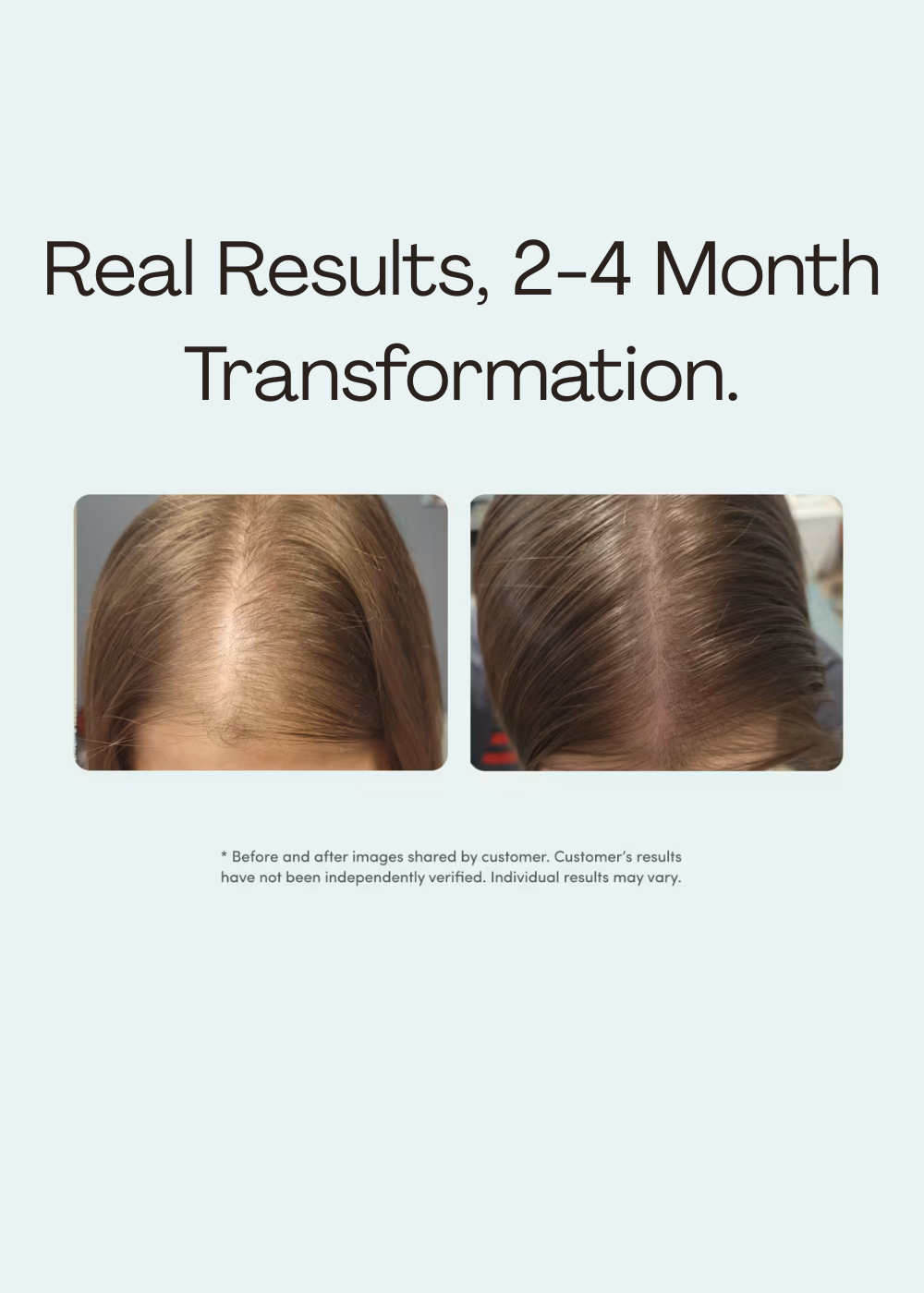 Hair Growth Serum